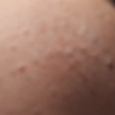 Close-up of Eucerin eczema cream texture