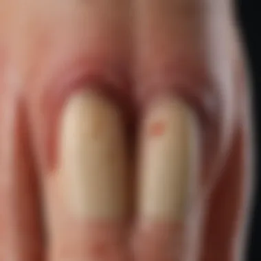 Anatomy of a Toenail Detailed diagram showing the anatomy of a toenail